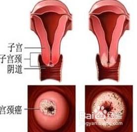 算命的说我子宫不好就真的不好怎么办-第2张图片-周易占卜网 - 免费算命_生辰八字算命_八字合婚姻