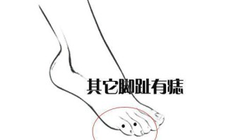 脚上有痦子算命(手背上有痦子好吗周易算命)